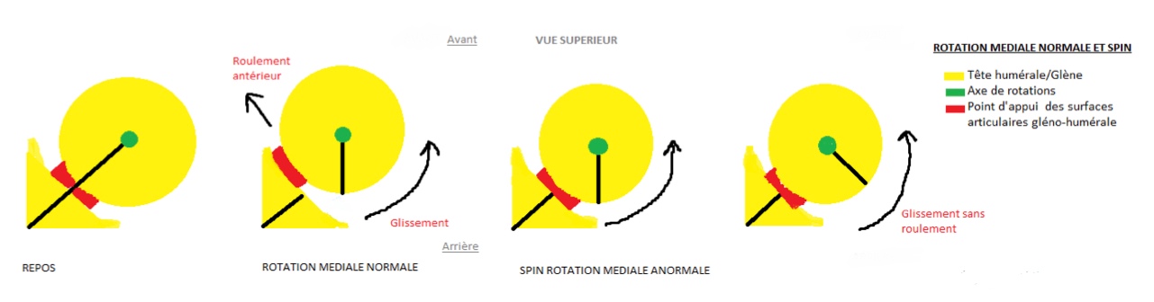 décentrage rotatoire de l'épaule ou spin