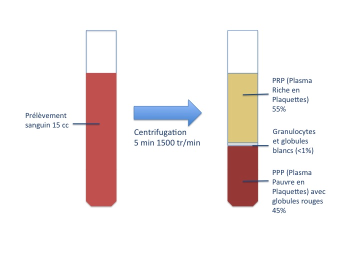 procédé de récupération du concentré
plaquettaire (PRP)